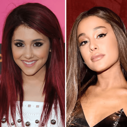 Ariana Grande Plastic lip Surgery